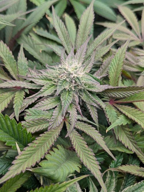 Is this permanent? FMG. Week 5