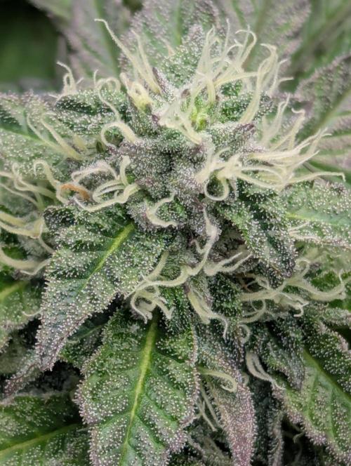 Is this permanent? FMG. Week 5