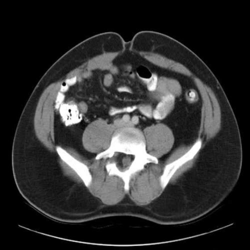 Montel tragic rise fall of Jar Jar Binks