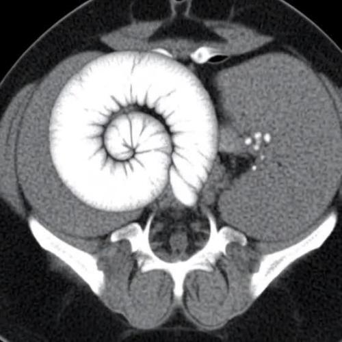 Montel tragic rise fall of Jar Jar Binks