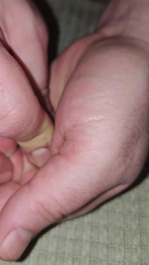 MOBY DICK - Barney's farm