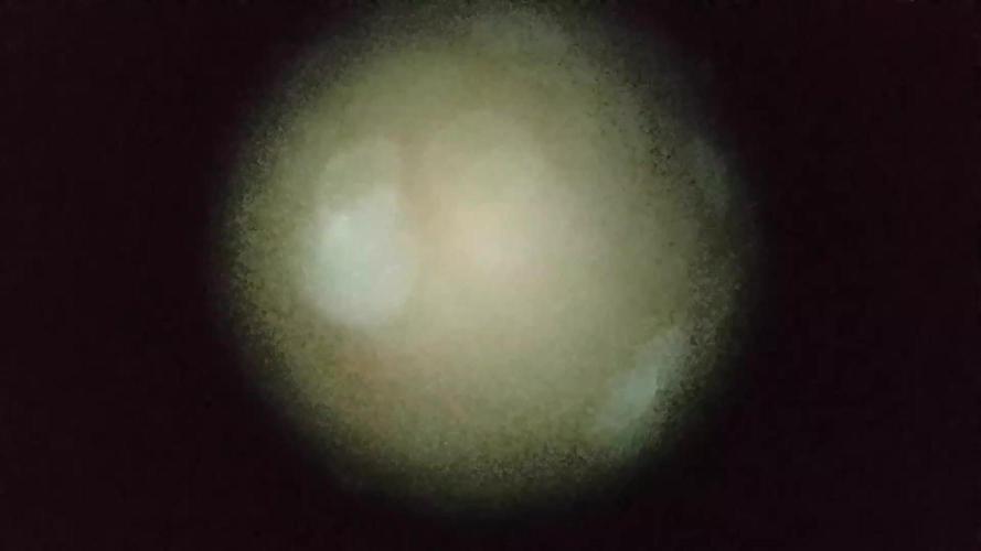 CBD 20:1 I & II 20gr