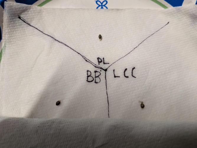 A purple and fruity Fastbuds trio. Week 0 - 3 little taproots