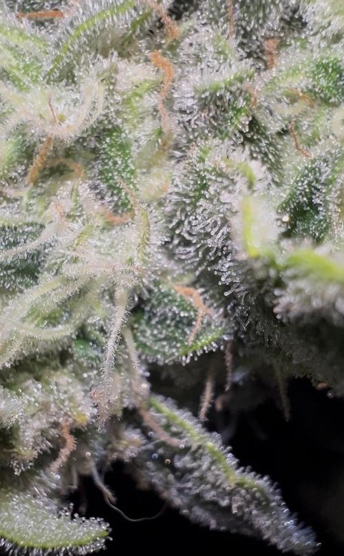 Auto Anesthesia. Week 17