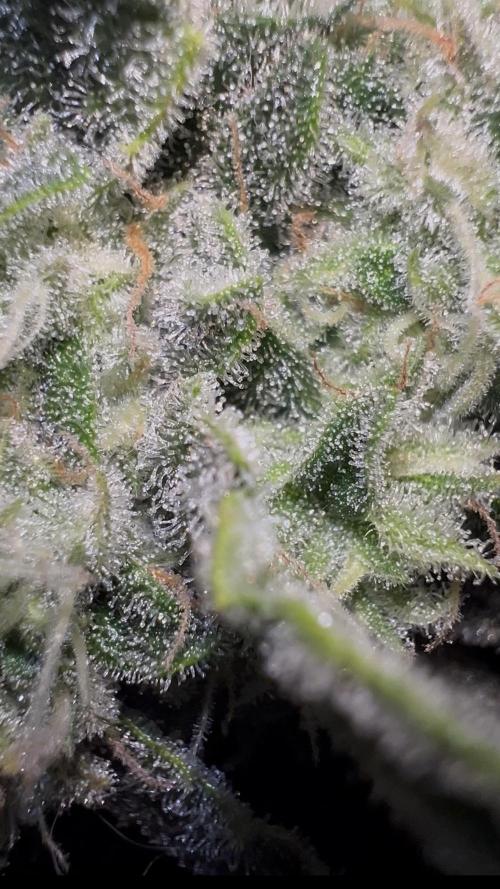 Auto Anesthesia. Week 17